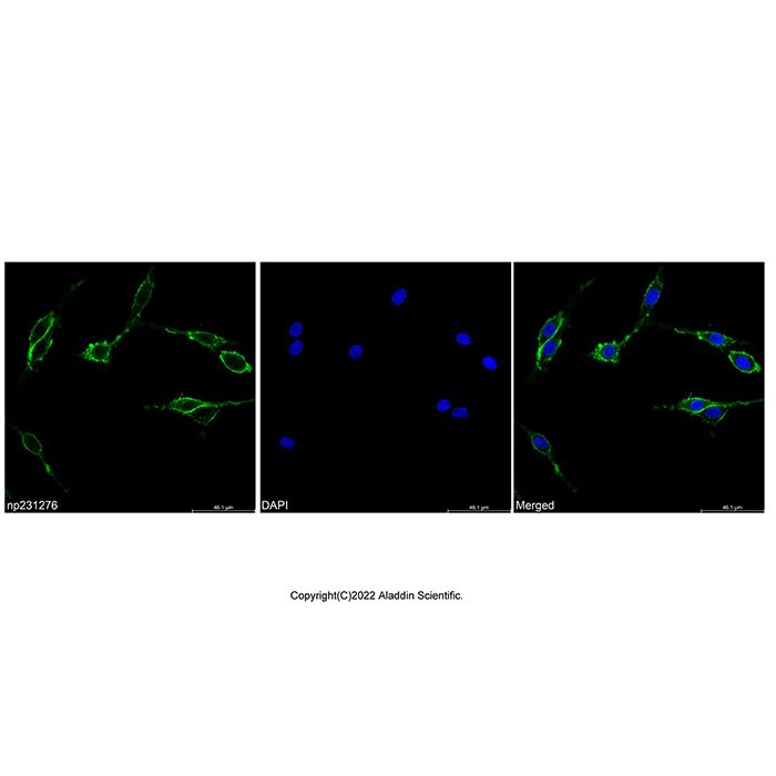 Concanavalin A, FITC conjugate -   CAS No(11028-71-0) by Aladdin Scientific