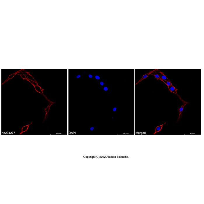 Concanavalin A, Biotin conjugate -   CAS No(11028-71-0) by Aladdin Scientific