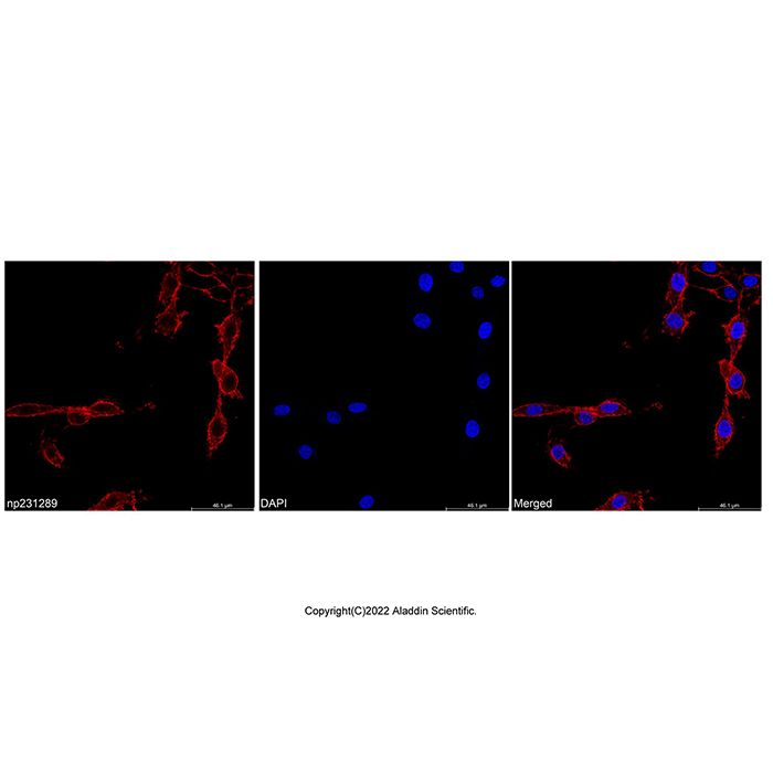 Wheat Germ Agglutinin (WGA), TRITC conjugate -   CAS No(96508-08-6) by Aladdin Scientific