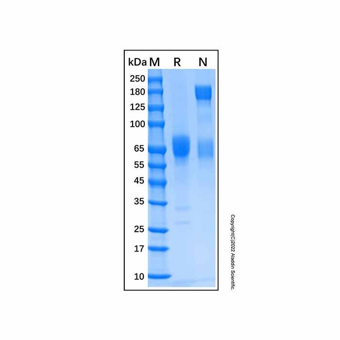 Recombinant Human IFN-alpha/beta R2 Protein -    by Aladdin Scientific