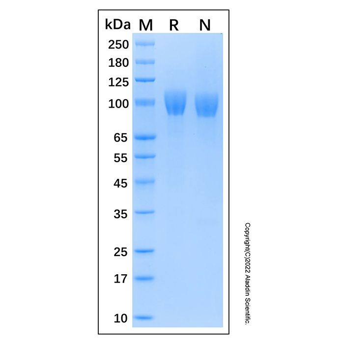 Recombinant Human NG2/MCSP/CSPG4 Protein -    by Aladdin Scientific