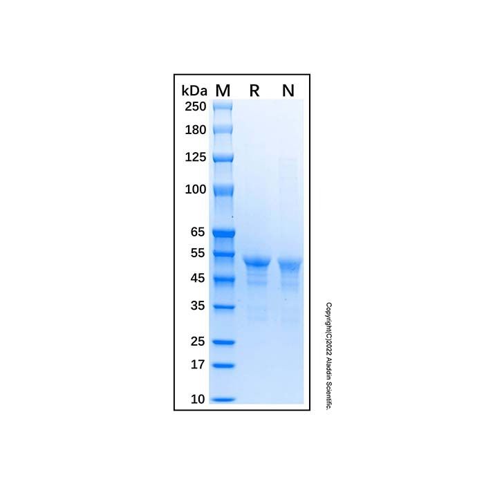 Recombinant Human Carbonic Anhydrase IX Protein -    by Aladdin Scientific
