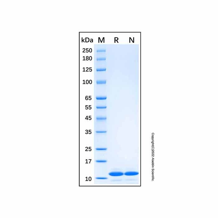 Recombinant Human PTH Protein -    by Aladdin Scientific