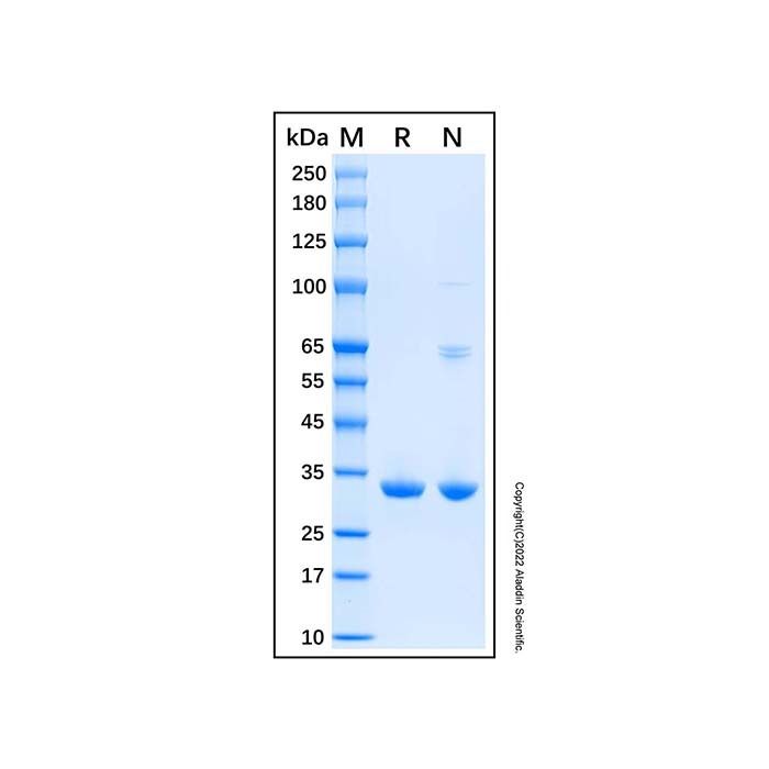Recombinant Human SULT1A1 Protein -    by Aladdin Scientific