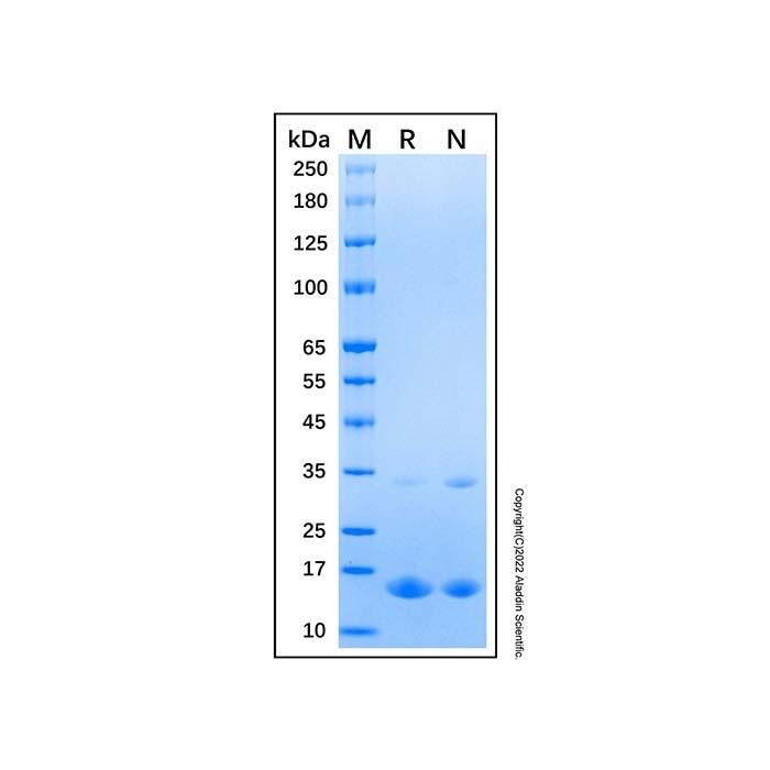 Recombinant Human CDK2AP2 Protein -    by Aladdin Scientific