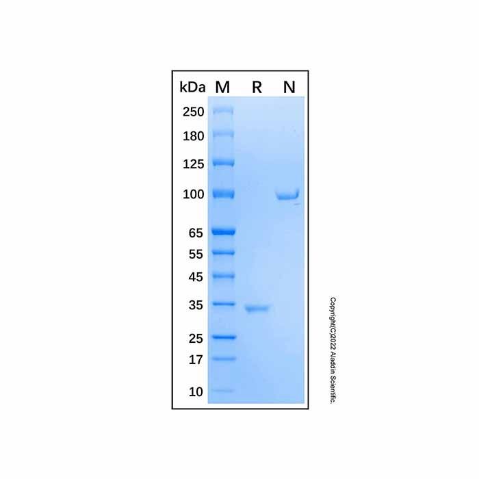 Recombinant Human Pro-Collagen II Protein -    by Aladdin Scientific