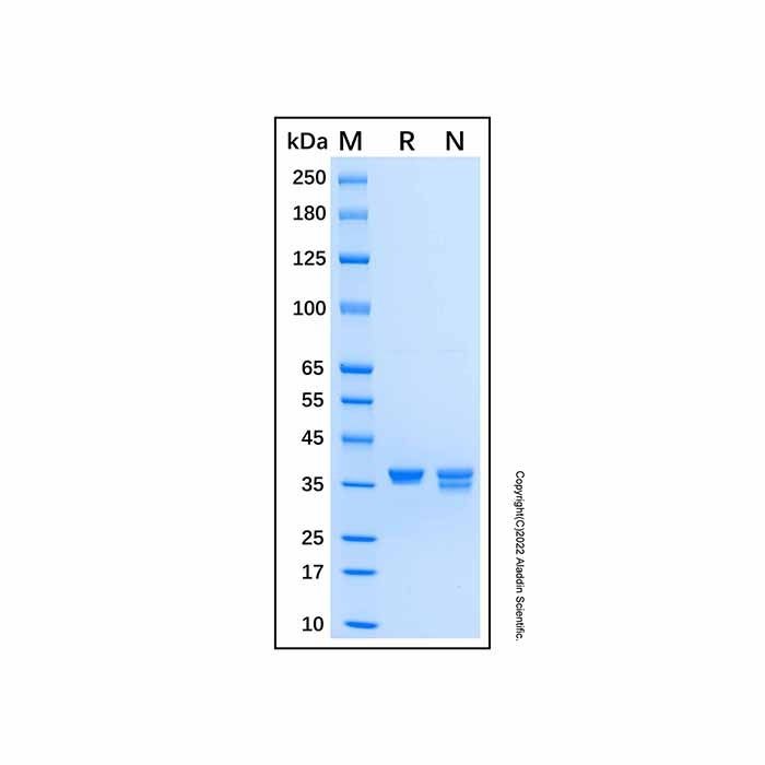 Recombinant Human DEP-1/CD148 Protein -    by Aladdin Scientific