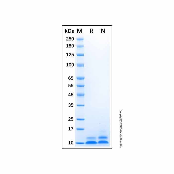 Recombinant Human beta Defensin 5 Protein -    by Aladdin Scientific