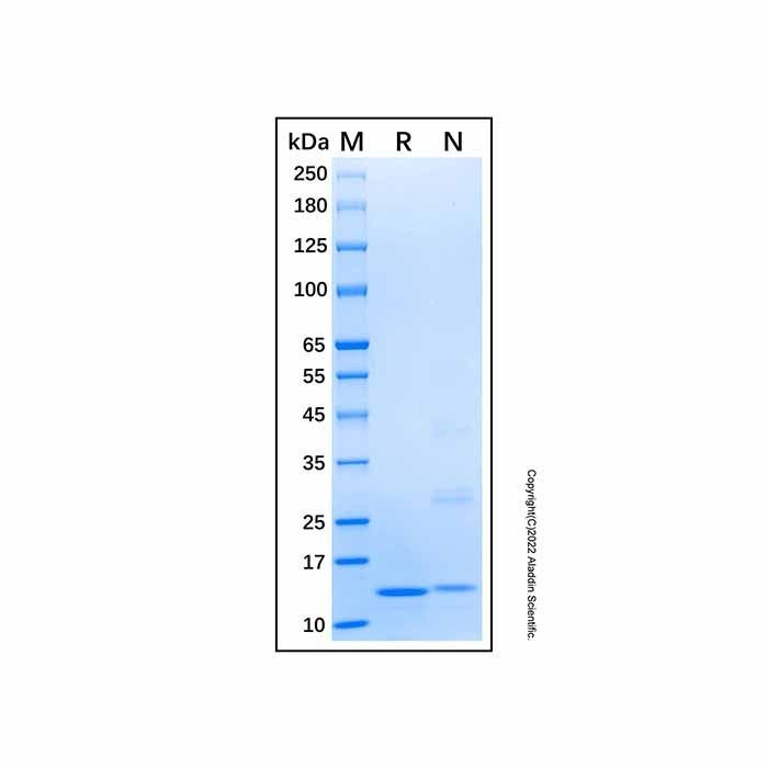 Recombinant Human EIF1B Protein -    by Aladdin Scientific