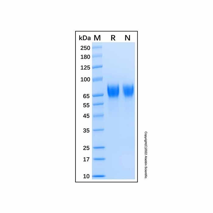 Recombinant Human CEACAM-20 Protein -    by Aladdin Scientific