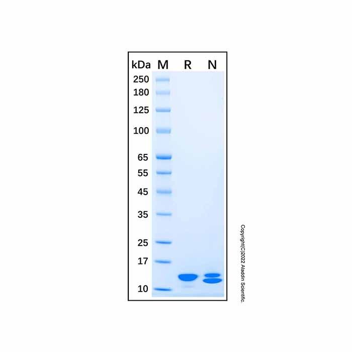 Recombinant Human S100A7A Protein -    by Aladdin Scientific