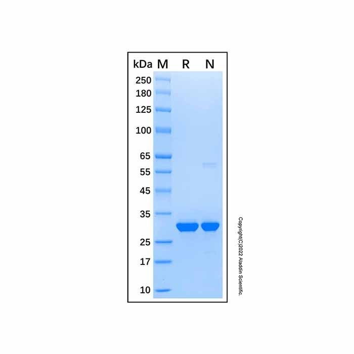 Recombinant Human CRYBB1 Protein -    by Aladdin Scientific