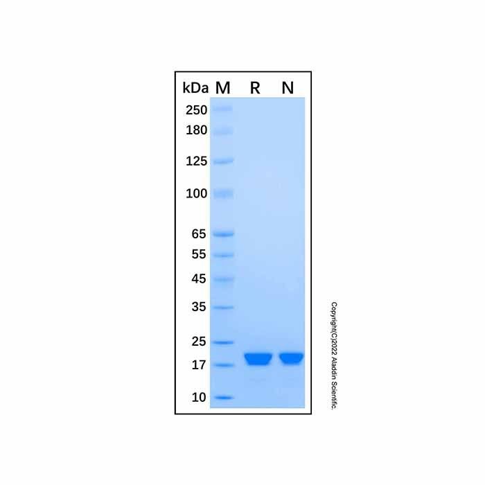 Recombinant Human CRYGD Protein -    by Aladdin Scientific
