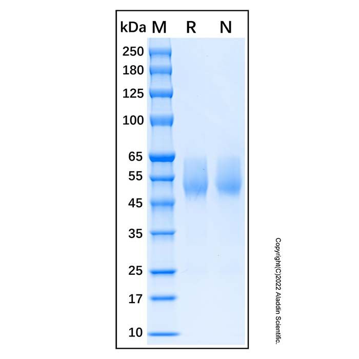 Recombinant Human Serpin A3 Protein -    by Aladdin Scientific
