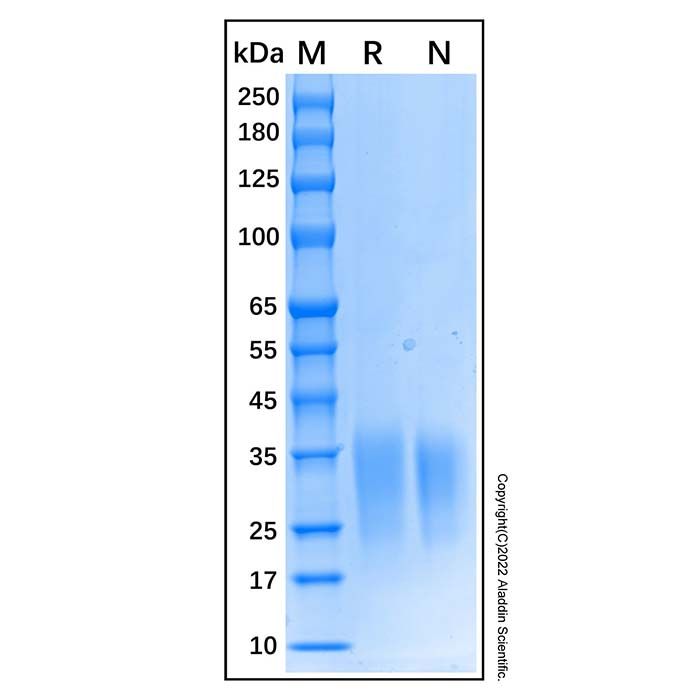 Recombinant Human Activin RIIA Protein -    by Aladdin Scientific