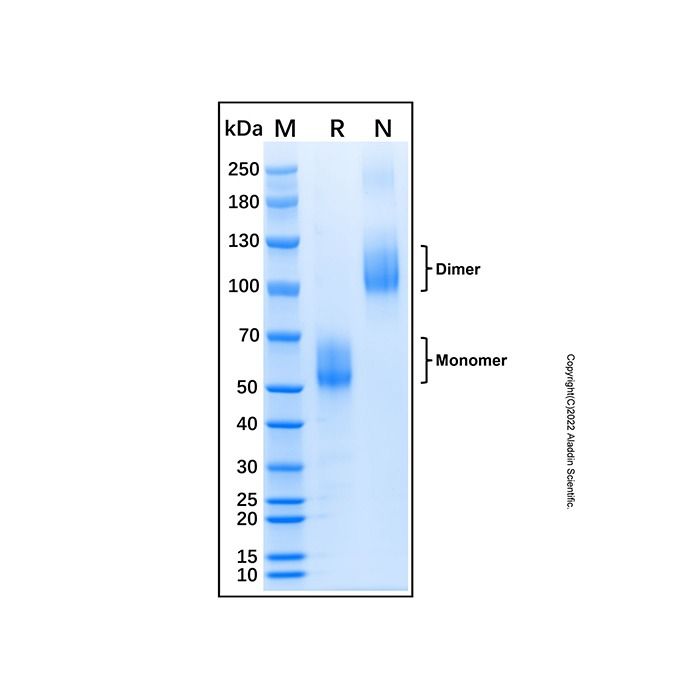 Recombinant Human Activin RIIB Protein -    by Aladdin Scientific