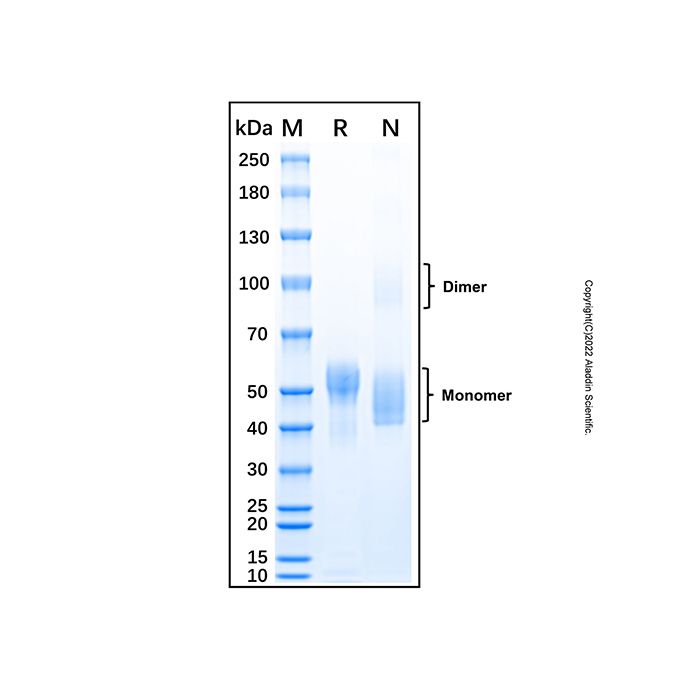 Recombinant Human Fetuin A/AHSG Protein -    by Aladdin Scientific