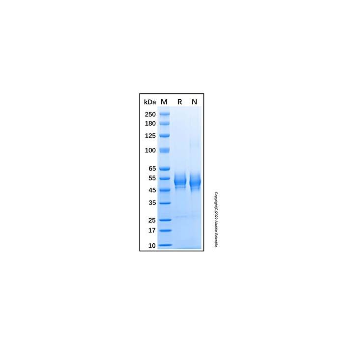 Recombinant Human B4GalT1 Protein -    by Aladdin Scientific