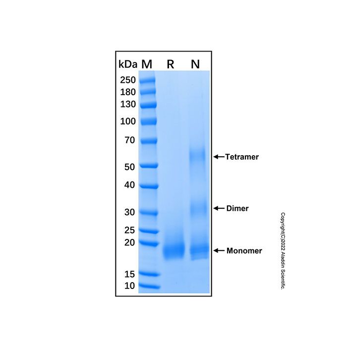 Recombinant Human BMPR-IB/ALK-6 Protein -    by Aladdin Scientific