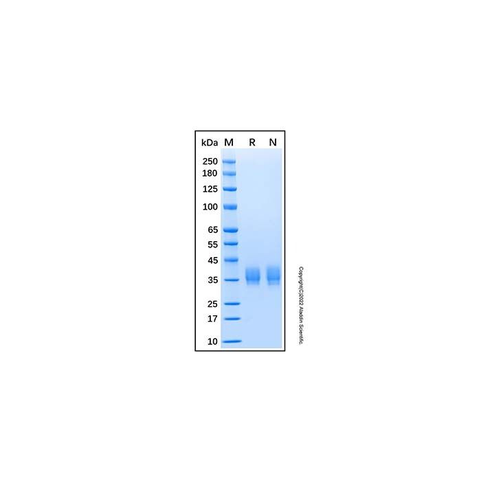 Recombinant Human Carbonic Anhydrase XII Protein -    by Aladdin Scientific