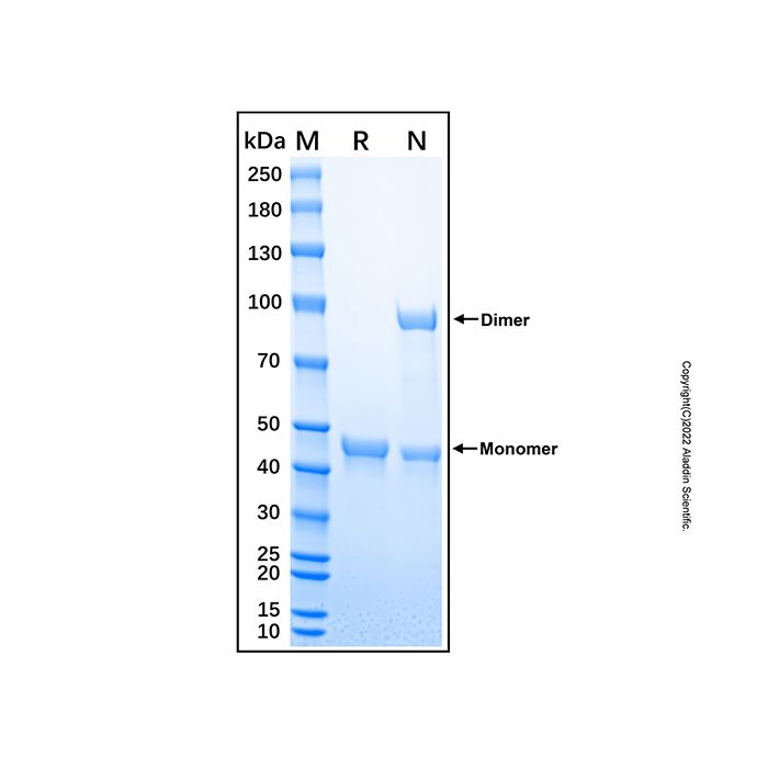 Recombinant Human Cathepsin E Protein -    by Aladdin Scientific