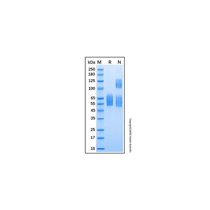 Recombinant Human SR-AI/MSR Protein -    by Aladdin Scientific