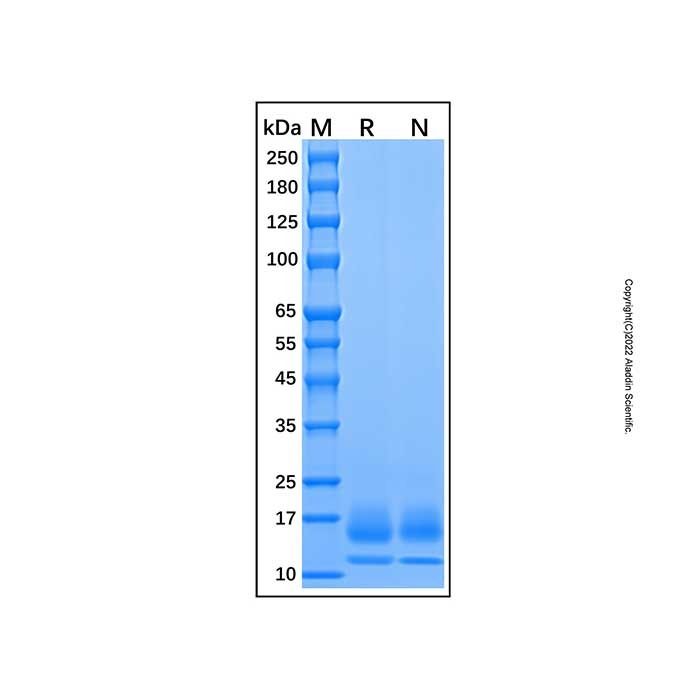 Recombinant Human CD59 Protein -    by Aladdin Scientific