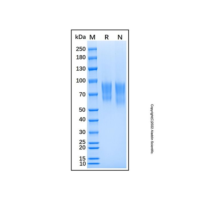Recombinant Human CD6 Protein -    by Aladdin Scientific