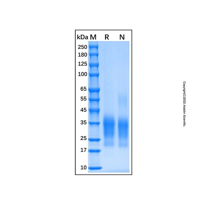 Recombinant Human CD79B Protein -    by Aladdin Scientific