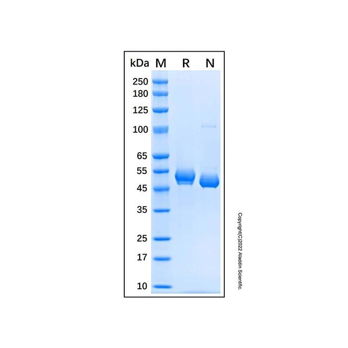 Recombinant Human Chitotriosidase/CHIT1 Protein -    by Aladdin Scientific