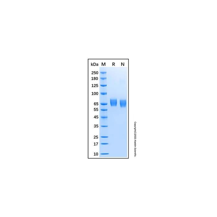 Recombinant Human CHST15 Protein -    by Aladdin Scientific