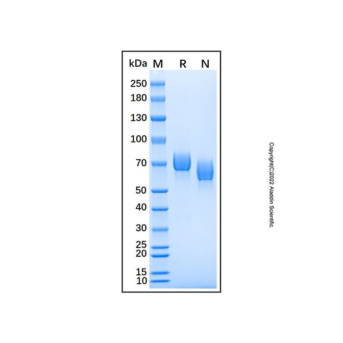 Recombinant Human EphA3 Protein -    by Aladdin Scientific