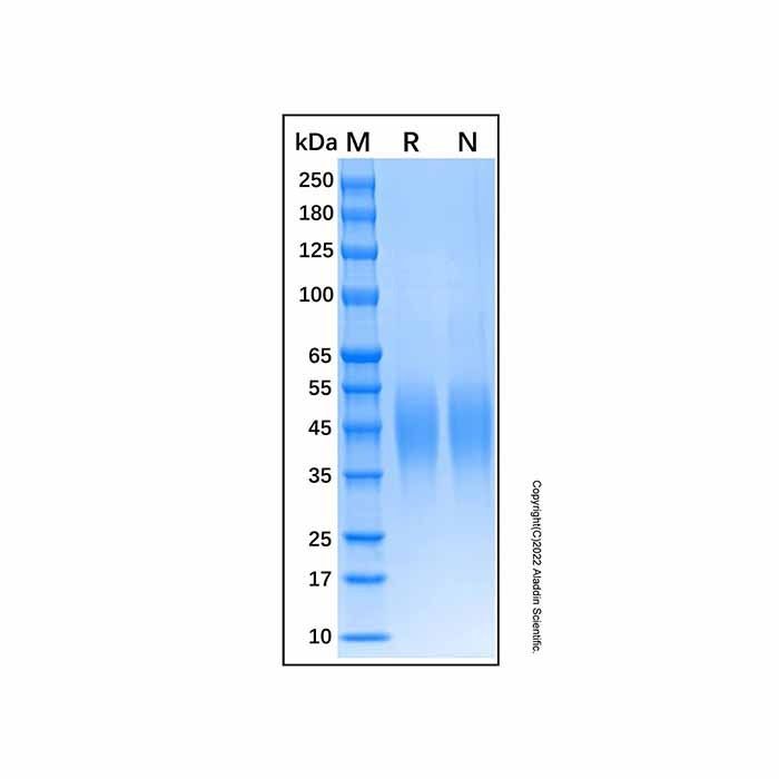 Recombinant Human Fc epsilon RI alpha Protein -    by Aladdin Scientific