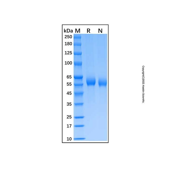 Recombinant Human FGFR5/FGFRL1 Protein -    by Aladdin Scientific
