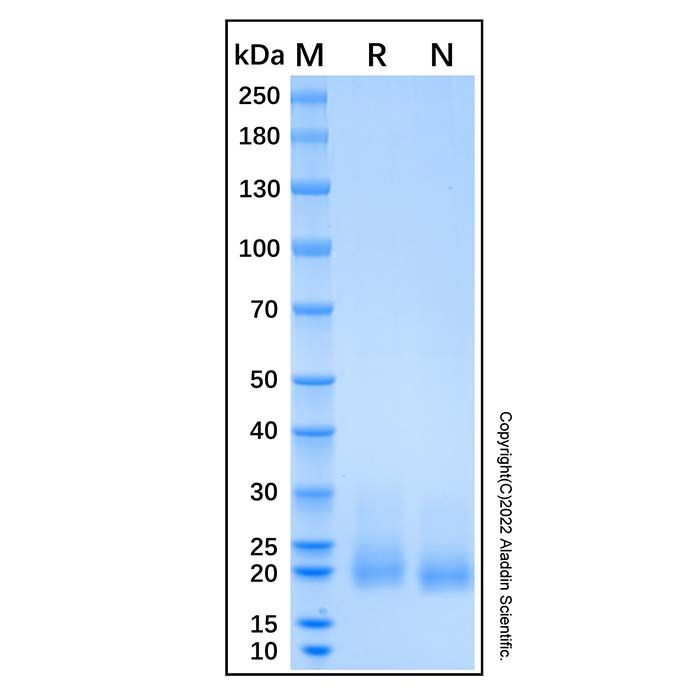 Recombinant Human Frizzled-10 Protein -    by Aladdin Scientific