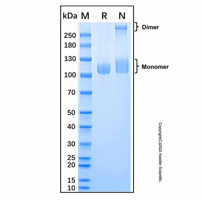 Recombinant Human Lysosomal alpha-Glucosidase/GAA Protein -    by Aladdin Scientific