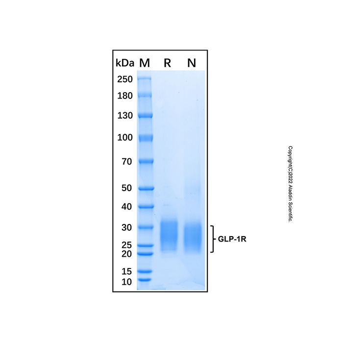 Recombinant Human GLP-1R Protein -    by Aladdin Scientific