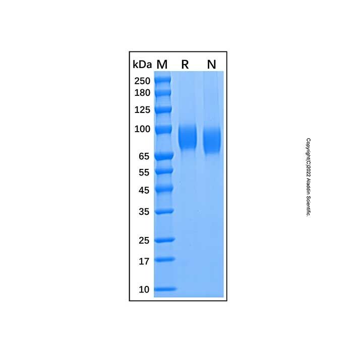 Recombinant Human Osteoactivin/GPNMB Protein -    by Aladdin Scientific