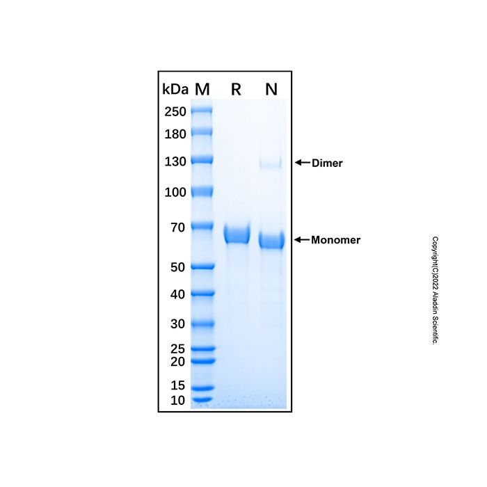 Recombinant Human Hexosaminidase B/HEXB Protein -    by Aladdin Scientific