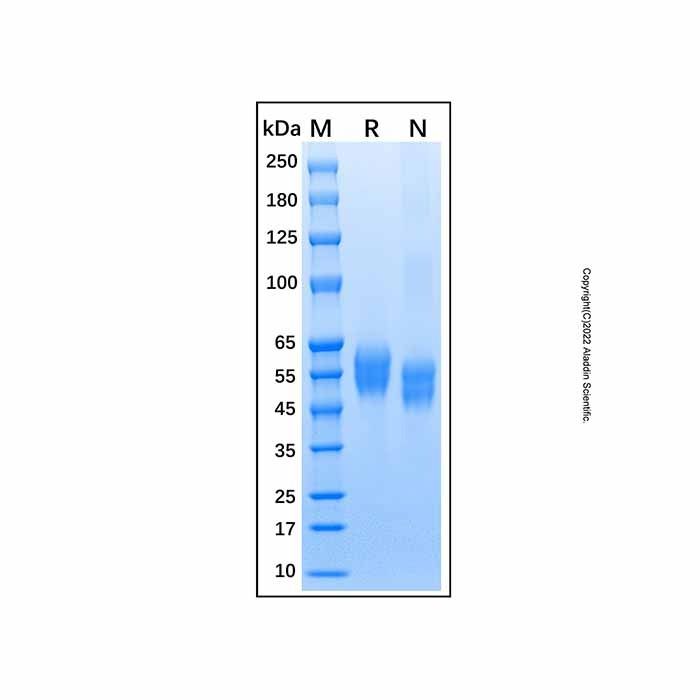 Recombinant Human IL1 Receptor I/IL-1R-1 Protein -    by Aladdin Scientific