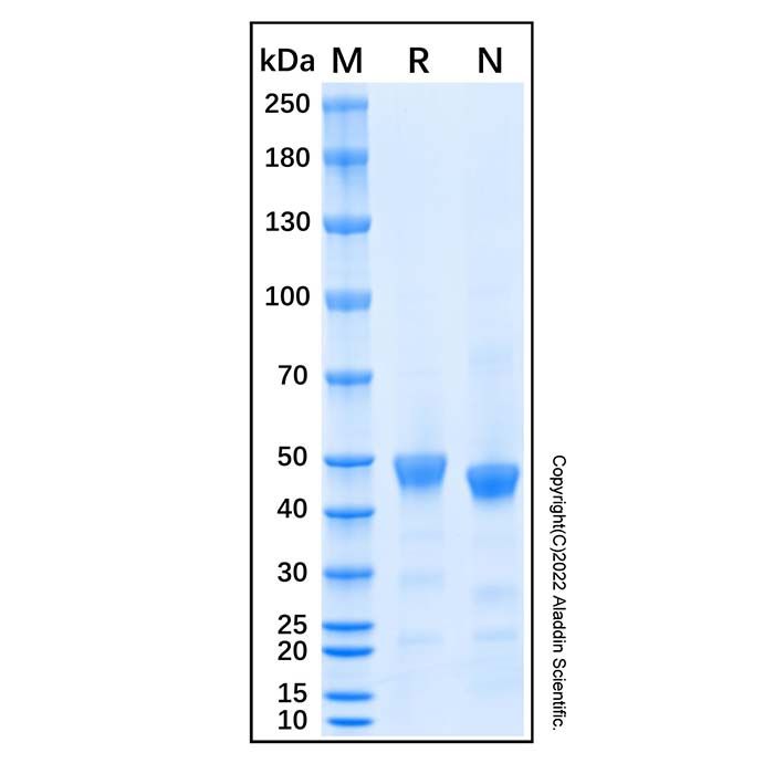 Recombinant Human IL-11 R alpha Protein -    by Aladdin Scientific