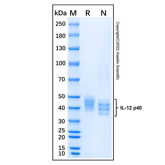 Recombinant Human IL-12 p40 Protein -    by Aladdin Scientific