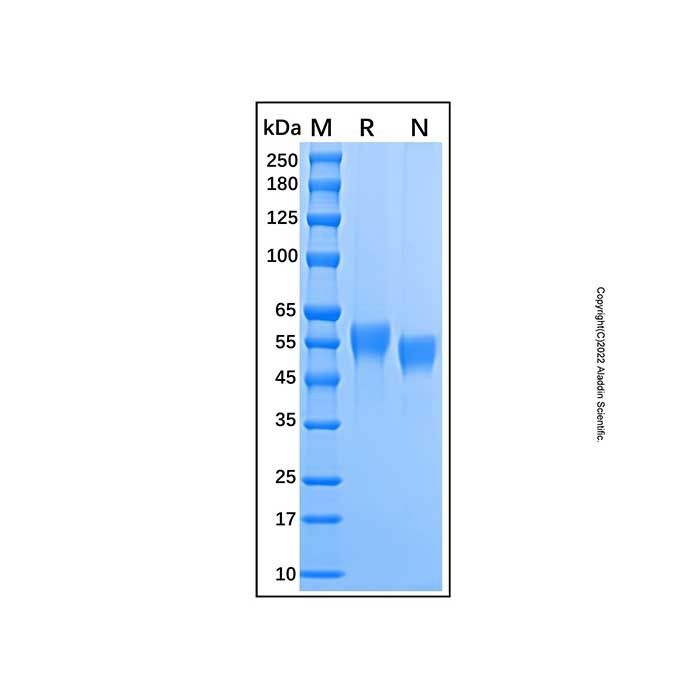 Recombinant Human IL-18 R beta/IL-1 R7 Protein -    by Aladdin Scientific