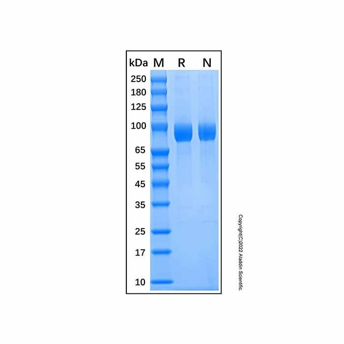 Recombinant Human IL-18 R alpha/IL-1 R5 Protein -    by Aladdin Scientific