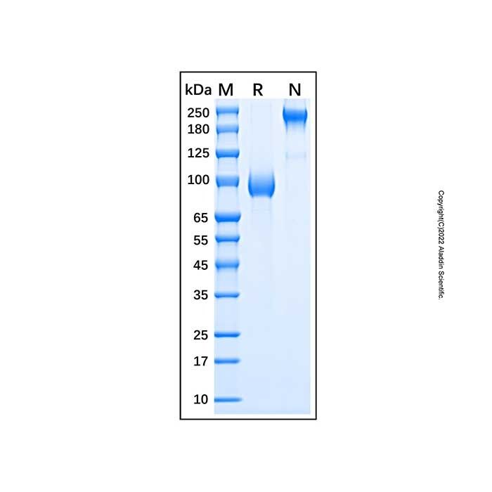 Recombinant Human IL-23R Protein -    by Aladdin Scientific