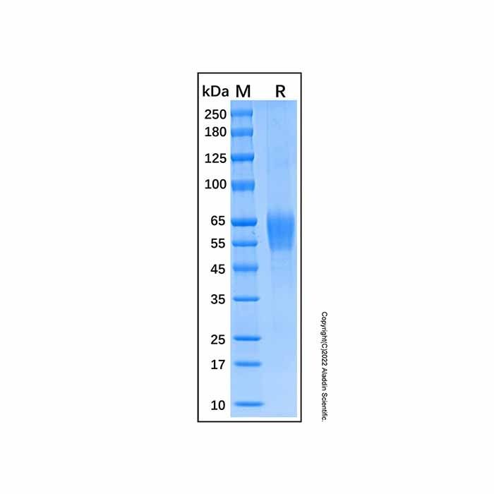 Recombinant Human IL-1Rrp2/IL-1R6 Protein -    by Aladdin Scientific