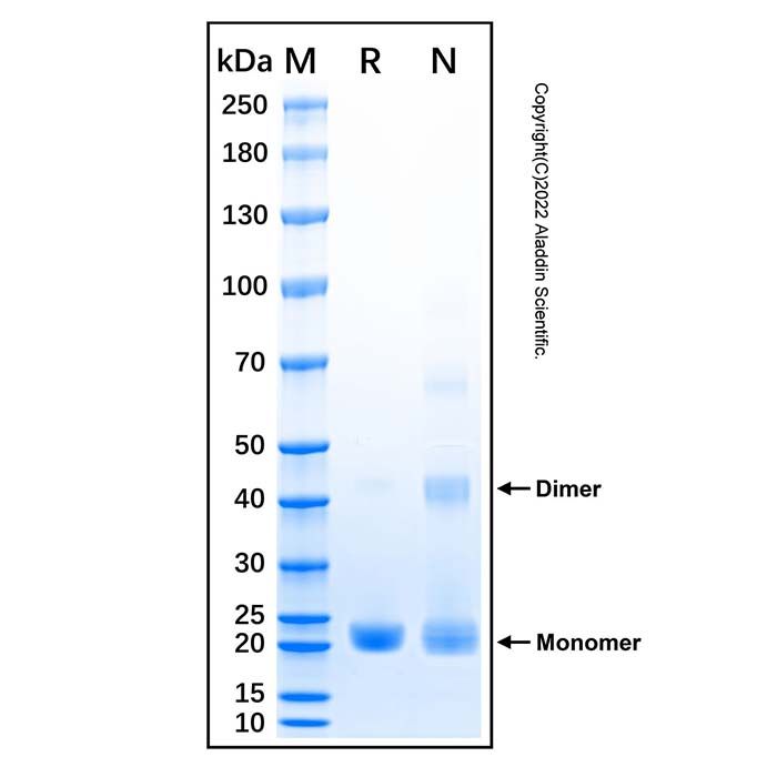 Recombinant Human IL-37 Protein -    by Aladdin Scientific