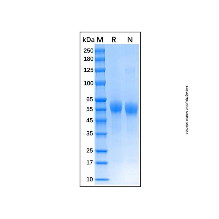 Recombinant Human IL-3RB Protein -    by Aladdin Scientific