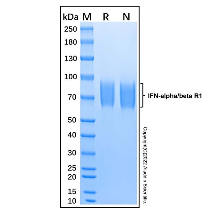 Recombinant Human IFN-alpha/beta R1 Protein -    by Aladdin Scientific