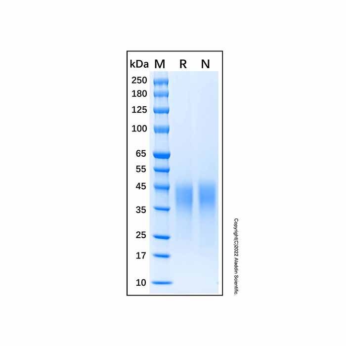 Recombinant Human LIF Protein -    by Aladdin Scientific